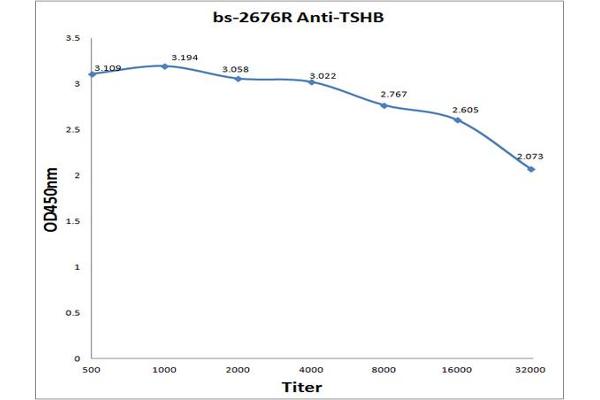 TSH antibody  (AA 51-138)