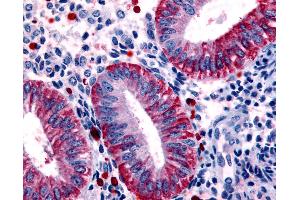 Anti-DKK1 antibody IHC of human uterus, endometrium. (DKK1 antibody  (Internal Region))