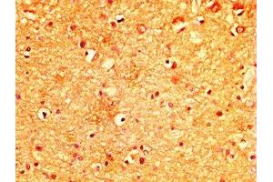 IHC image of ABIN7174953 diluted at 1:300 and staining in paraffin-embedded human brain tissue performed on a Leica BondTM system. (MYO5A antibody  (AA 1087-1220))