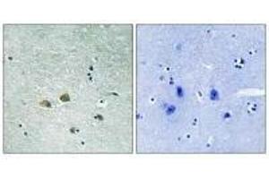 Immunohistochemistry analysis of paraffin-embedded human brain tissue using PAK1 (Ab-204) antibody. (PAK1 antibody  (Ser204))