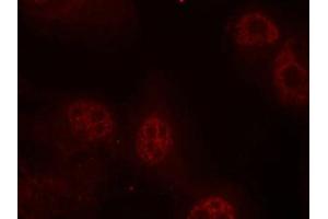 Immunofluorescence staining of methanol-fixed Hela cells using Myc(Phospho-Ser62) Antibody. (c-MYC antibody  (pSer62))