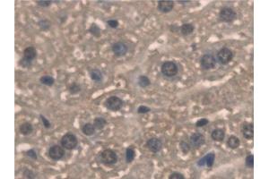 Detection of PNPO in Mouse Liver Tissue using Polyclonal Antibody to Pyridoxamine-5'-Phosphate Oxidase (PNPO) (PNPO antibody  (AA 1-261))