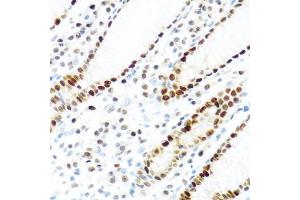 Immunohistochemistry of paraffin-embedded human stomach using KHDRBS2 antibody (ABIN5975782) at dilution of 1/100 (40x lens).