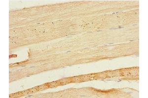 Immunohistochemistry of paraffin-embedded human skeletal muscle tissue using ABIN7152072 at dilution of 1:100 (EHF antibody  (AA 1-210))
