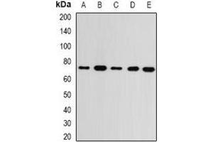 Western blot analysis of GMPS expression in MCF7 (A), SKOV3 (B), mouse kidney (C), mouse brain (D), rat heart (E) whole cell lysates. (GMP Synthase antibody)
