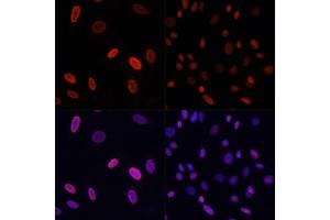 Immunofluorescence analysis of NIH/3T3 cells using Acetyl-Histone H3-K9 antibody (ABIN7267675) at dilution of 1:100 (40x lens). (Histone 3 antibody  (H3K9))