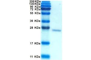 SDS-PAGE with Coomassie Blue staining