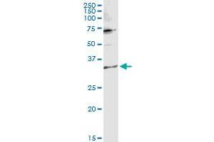 TTC1 anticorps  (AA 1-292)