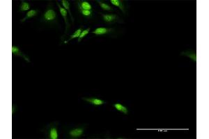 Immunofluorescence of purified MaxPab antibody to DNAJB4 on HeLa cell.