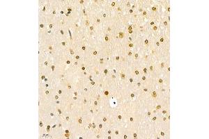 Immunohistochemistry of paraffin embedded rat brain using HOXC9 (ABIN7074251) at dilution of 1:700 (400x lens) (HOXC9 antibody)