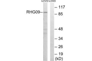 Western blot analysis of extracts from LOVO cells, using RHG9 antibody. (ARHGAP9 antibody  (Internal Region))
