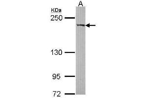 WB Image Sample (30 ug of whole cell lysate) A: A431 , 5% SDS PAGE antibody diluted at 1:1000 (RECQL2 antibody  (Center))