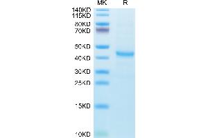 Human CXCL13 on Tris-Bis PAGE under reduced condition. (CXCL13 Protein (AA 23-109) (Fc Tag))