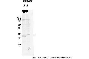 Sample Type: 2. (Peroxiredoxin 1 antibody  (N-Term))