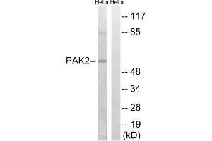 Western Blotting (WB) image for anti-P21-Activated Kinase 2 (PAK2) (Ser141) antibody (ABIN1848251) (PAK2 antibody  (Ser141))