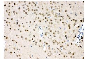 IHC analysis of VCP using anti-VCP antibody (ABIN3043958). (VCP antibody  (C-Term))