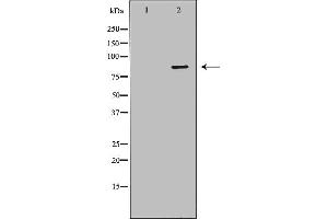 Western blot analysis of Hela whole cell lysates, using IMMT Antibody. (IMMT antibody  (Internal Region))