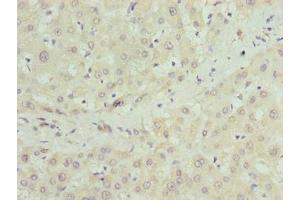 Immunohistochemistry of paraffin-embedded human liver tissue using ABIN7149063 at dilution of 1:100 (CRISPLD1 antibody  (AA 24-300))
