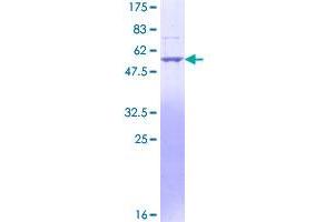 Endonuclease G Protein (ENDOG) (AA 50-297) (GST tag)