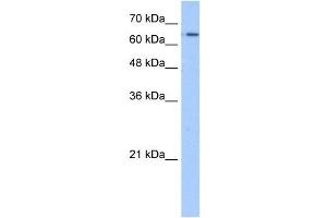 SLC22A11 antibody used at 1.