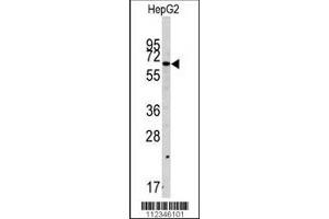 Western blot analysis of anti-SWAP70 Antibody in HepG2 cell line lysates (35ug/lane). (SWAP70 antibody  (AA 227-256))