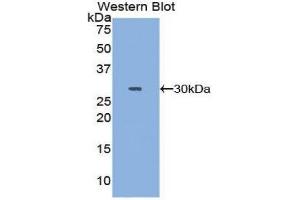 Western Blotting (WB) image for anti-DNA Topoisomerase II (TOP2) (AA 923-1148) antibody (ABIN1860829)