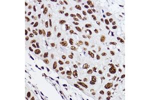 Immunohistochemistry of paraffin-embedded human esophageal using GTF2F2 Rabbit mAb (ABIN7267373) at dilution of 1:100 (40x lens). (GTF2F2 antibody)
