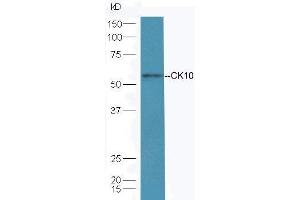 Mouse skin lysate probed  at 1:5000 90min in 37˚C. (Keratin 10 antibody  (AA 151-250))