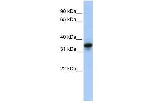 MUC3B antibody used at 1 ug/ml to detect target protein. (MUC3B antibody  (N-Term))