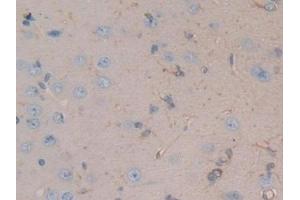 Immunohistochemistry (IHC) image for anti-Microtubule-Associated Protein 4 (MAP4) (AA 2-250) antibody (ABIN7433462)