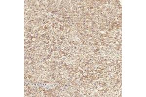 Immunohistochemical analysis of paraffin-embedded Human-liver tissue. (TGFBR1 antibody  (pSer165))