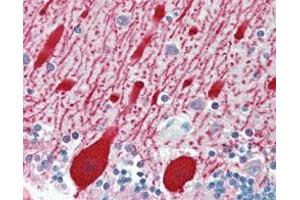 Immunohistochemistry (IHC) image for anti-alpha-Methylacyl-CoA Racemase (AMACR) antibody (ABIN968957)