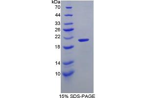 Image no. 1 for Integrin Alpha2b (CD41) (AA 891-1039) protein (His tag) (ABIN4988584) (Integrin Alpha2b Protein (CD41) (AA 891-1039) (His tag))