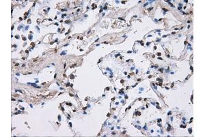 Image no. 14 for anti-ATP Synthase, H+ Transporting, Mitochondrial F1 Complex, beta Polypeptide (ATP5B) antibody (ABIN1496766) (ATP5B antibody)