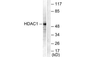 Western Blotting (WB) image for anti-Histone Deacetylase 1 (HDAC1) (C-Term) antibody (ABIN1848594)