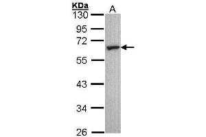 WB Image Sample (30 ug of whole cell lysate) A: A431 , 10% SDS PAGE antibody diluted at 1:1000 (HTR2C antibody  (C-Term))