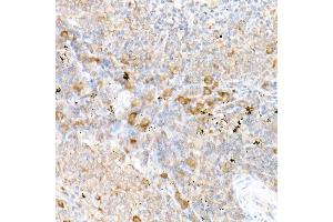 Immunohistochemistry (IHC) image for anti-CD81 (CD81) (AA 1-100) antibody (ABIN6138231)