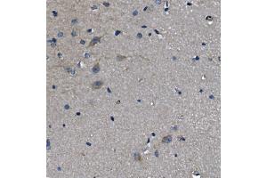 IHC analysis of ADRA1A using anti-ADRA1A antibody (ABIN3043732).