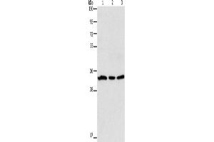 Western Blotting (WB) image for anti-Glycoprotein A33 (Transmembrane) (GPA33) antibody (ABIN2428182) (GPA33 antibody)