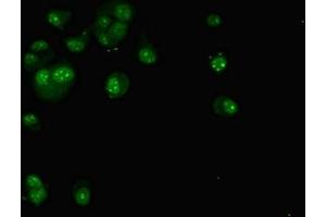 Immunofluorescent analysis of MCF-7 cells using ABIN7171562 at dilution of 1:100 and Alexa Fluor 488-congugated AffiniPure Goat Anti-Rabbit IgG(H+L) (TAF1C antibody  (AA 70-320))