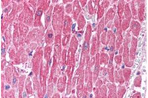 Human Heart (formalin-fixed, paraffin-embedded) stained with CLIC5 antibody ABIN214746 at 2. (CLIC5 antibody  (C-Term))