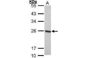 WB Image Sample (30 ug of whole cell lysate) A: 293T 12% SDS PAGE antibody diluted at 1:1000 (Peroxiredoxin 1 antibody)