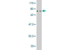 Western Blot detection against Immunogen (71. (Casein Kinase 1 gamma 2 antibody  (AA 1-415))