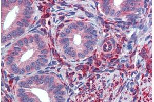 Human Uterus (formalin-fixed, paraffin-embedded) stained with SERPINH1 antibody ABIN462363 followed by biotinylated anti-mouse IgG secondary antibody ABIN481714, alkaline phosphatase-streptavidin and chromogen. (SERPINH1 antibody)