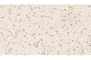 Detection of RETN in Human Cerebrum Tissue using Monoclonal Antibody to Resistin (RETN) (Resistin antibody  (AA 17-108))