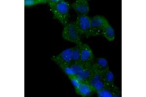 293 cells were stained with HDAC6 (6B4) Monoclonal Antibody  at 1:200 dilution, incubated overnight at 4C, followed by secondary antibody incubation, DAPI staining of the nuclei and detection. (HDAC6 antibody)