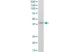 TCF2 monoclonal antibody (M06), clone 4E9. (HNF1B antibody  (AA 29-118))