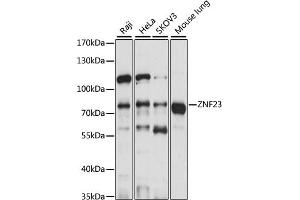 Western blot analysis of extracts of various cell lines, using ZNF23 antibody (ABIN7271469) at 1:1000 dilution.