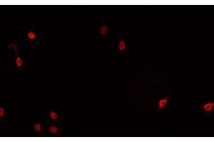 ABIN6266766 staining HeLa cells by IF/ICC. (TNFAIP8 antibody  (Internal Region))