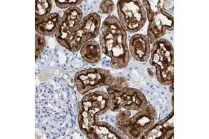 Immunohistochemical staining of human kidney with DPEP1 polyclonal antibody  shows strong cytoplasmic and membranous positivity in cells in tubules. (DPEP1 antibody)